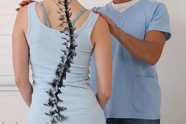 فیزیوتراپی برای اصلاح انحنای ستون فقرات