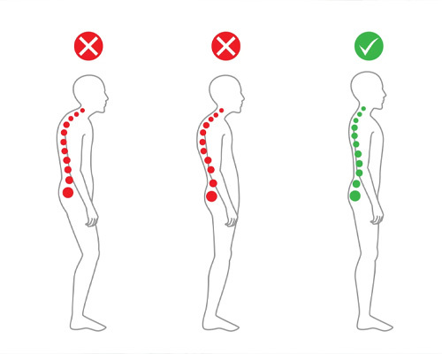 ناهنجاری‌های قامتی یا مشکلات پوسچرال در انسان