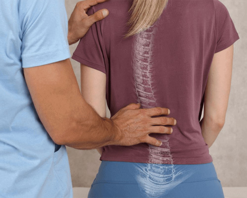فیزیوتراپی چگونه به اصلاح انحنای ستون فقرات کمک می‌کند؟