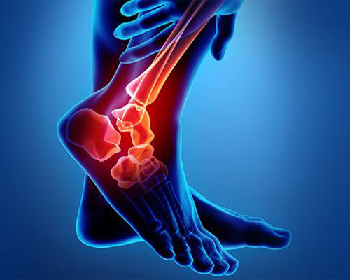 بیماری‌های ارتوپدی چیست؟ | فیزیوتراپی چگونه در مشکلات ستون فقزات کمک می‌کند؟